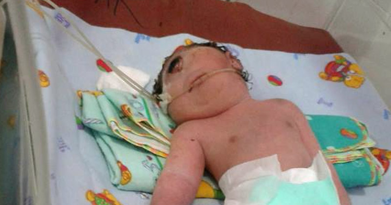 Bayi mata satu lahor di Panyabungan