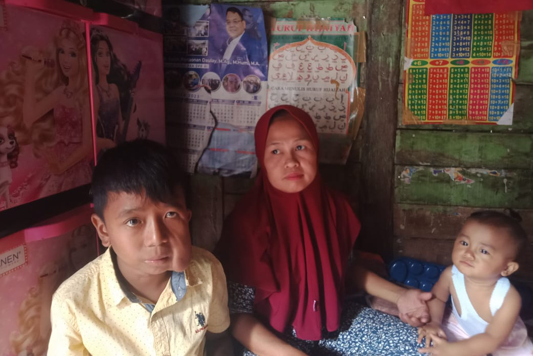 Pak Bupati, Ada Bocah Penderita Benjolan di Wajah di Desa Tanjung Jae Madina, Berharap Uluran Tangan