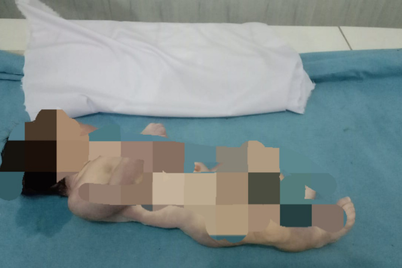 Terkait Penemuan Jasat Bayi,  Kapolres Madina Belum Dapat Laporan Perkembangan Dari Kapolsek