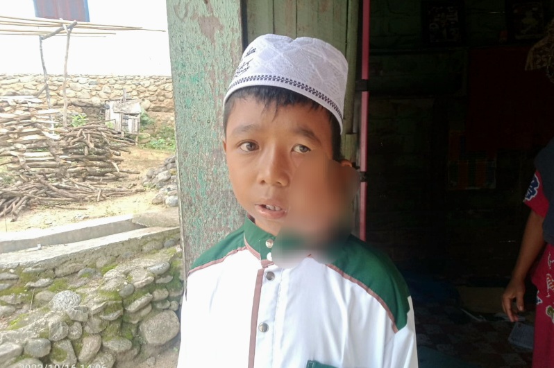 Pasca Operasi Cairan Diwajah, Suara Nasaruddin Mulai Normal